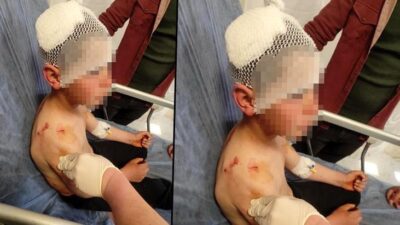 Isparta'da sokakta oynarken başıboş köpeğin saldırdığı 9 yaşındaki T.A. yaralandı.