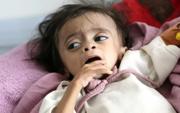 BMden Yemende insani kriz uyarısı
